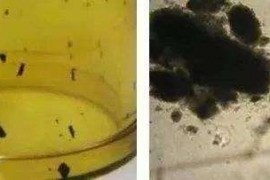 模具注塑黑点杂质总是清理不干净，你知道为什么？